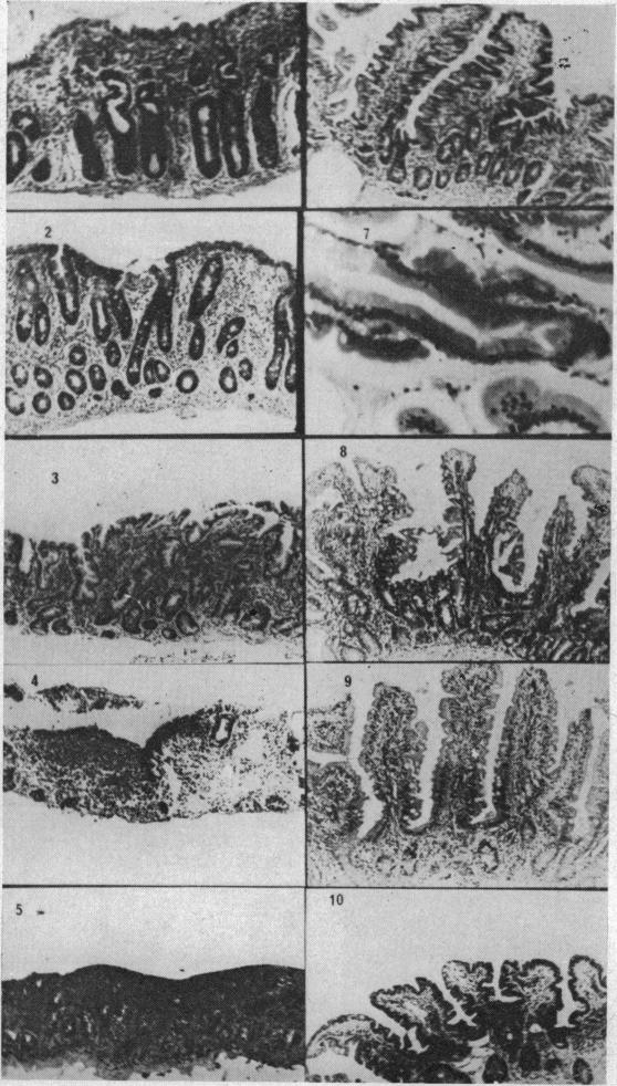 Fig 2a