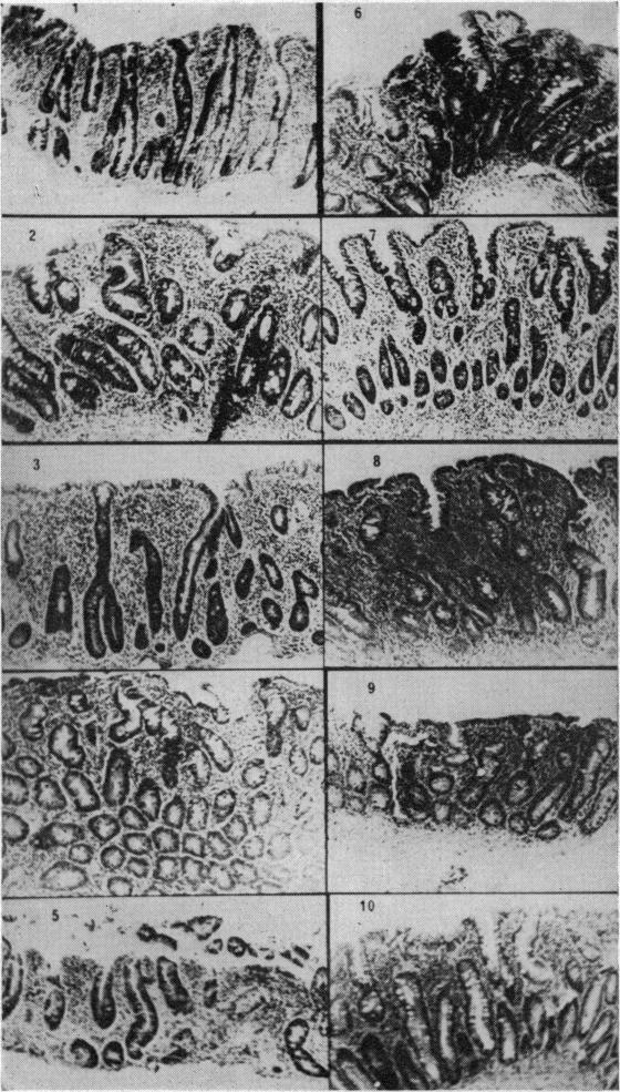 Fig 2b