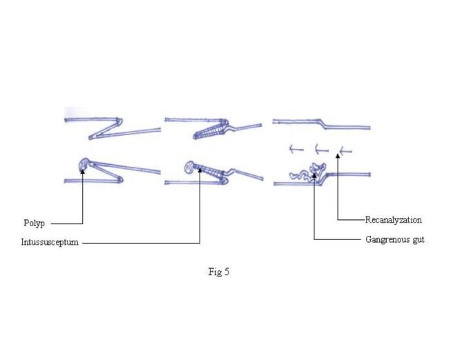 [Table/Fig-5]: