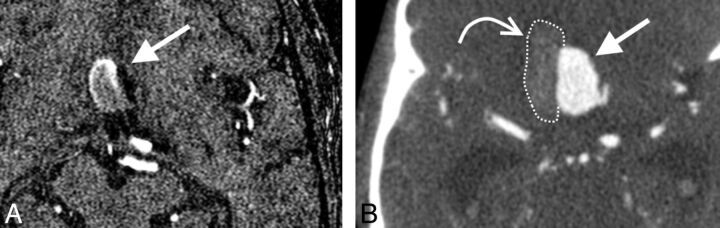 Fig 3.