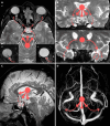 Figure 15