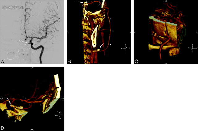 Fig 5.