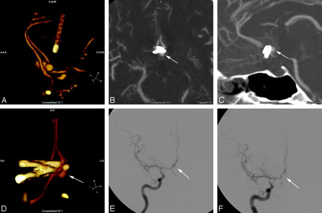 Fig 4.