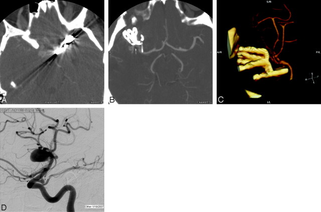 Fig 3.