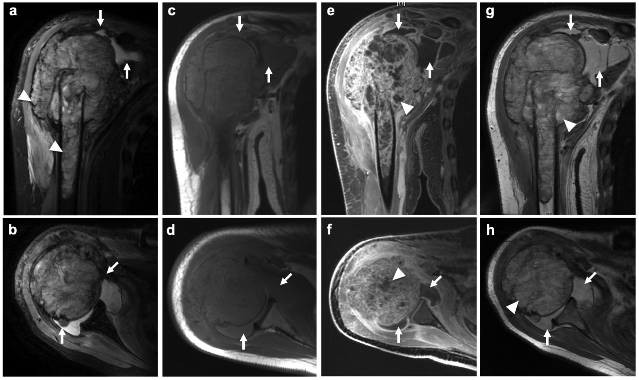 Fig.1