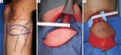 Figure 17
