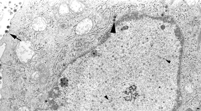 FIG. 11.