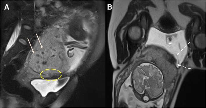 Fig. 17