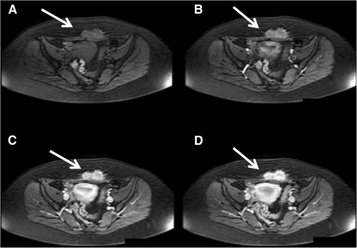 Fig. 12