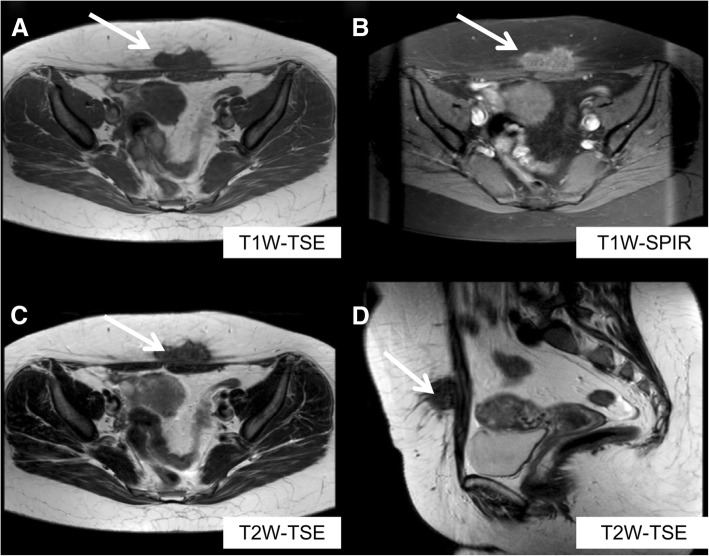 Fig. 11