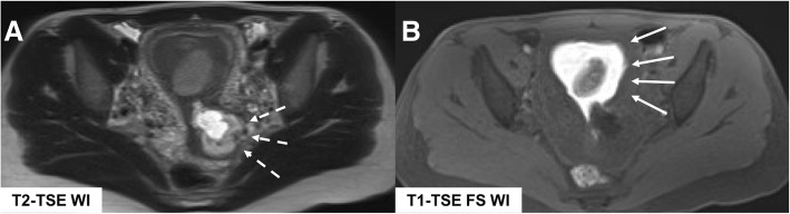 Fig. 14