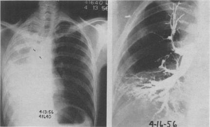 Fig. 15 (left)., Fig. 16 (right).