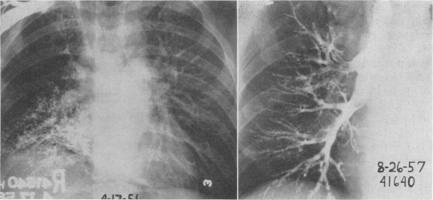 Fig. 17 (left)., Fig. 18 (right).