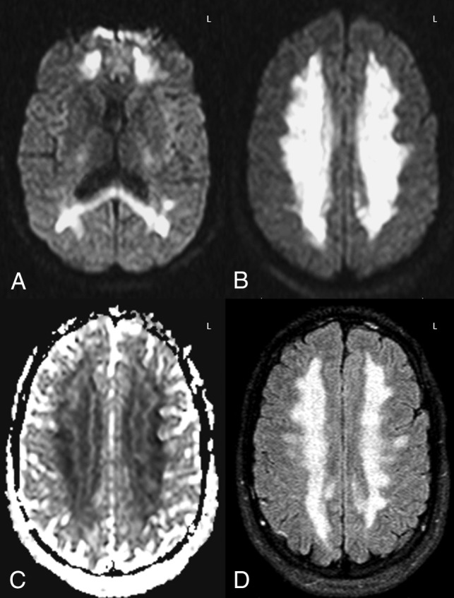 Fig 5.