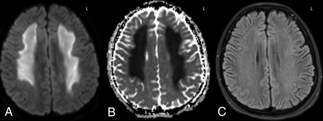 Fig 3.