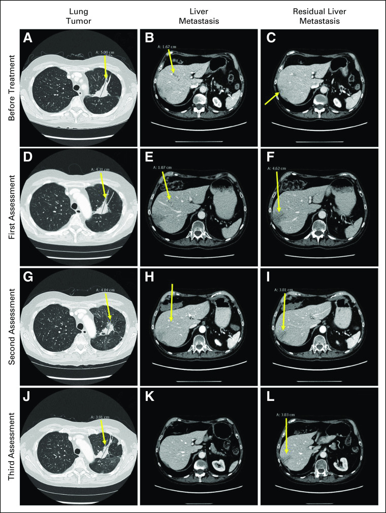 FIG 3.