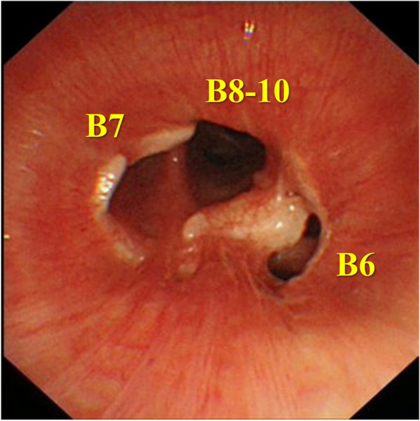 Fig. 5