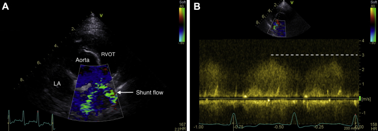 graphic file with name fx1.jpg