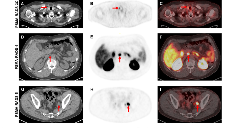 Fig. 1 –