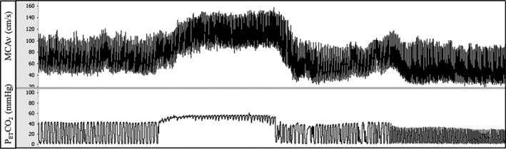 FIGURE 2