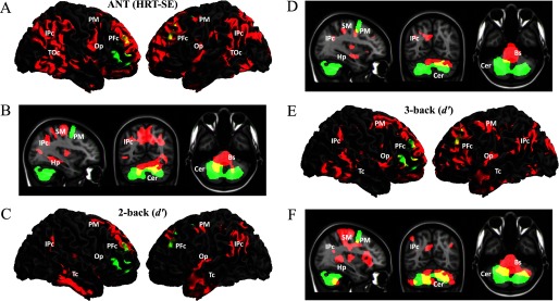 Figures 2A, 2C, and 2E are 3D renderings of right and left prefrontal cortex including clusters associated with lifelong greenness exposure as well as performance in cognitive tests. Figures 2B, 2D, and 2F are orthogonal displays of the brain including clusters associated with lifelong greenness exposure as well as performance in cognitive tests.