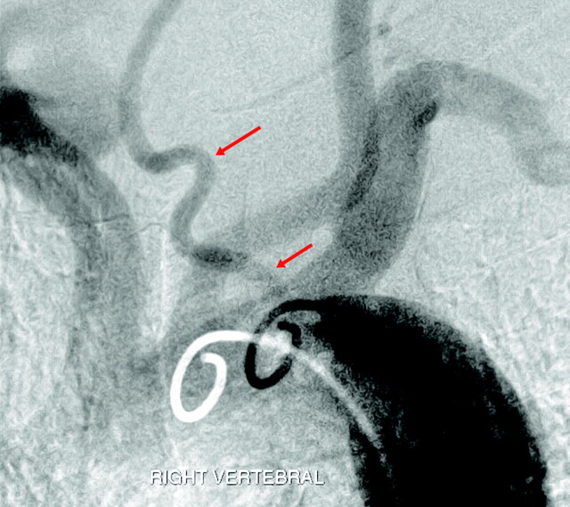 Fig 5.