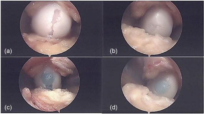 Figure 5.