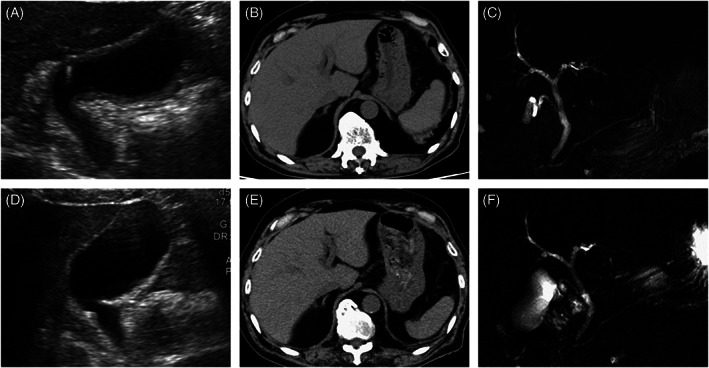 FIGURE 1