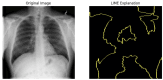 Figure 25