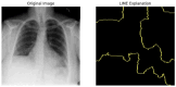 Figure 22