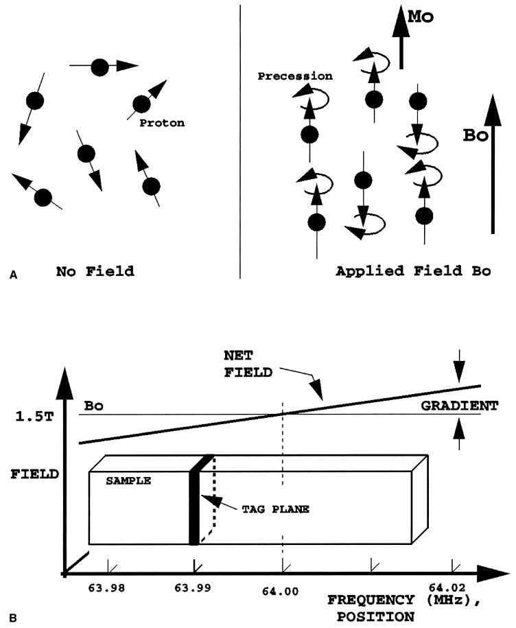 FIG. 1