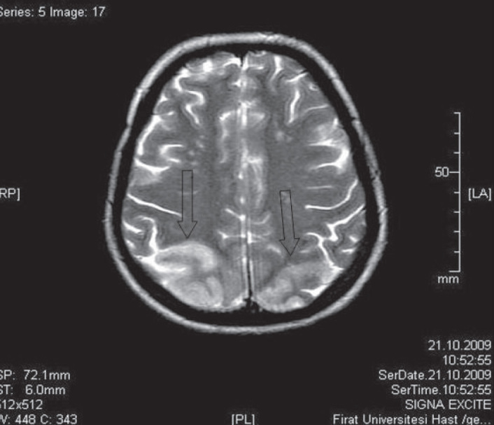 Figure 1a