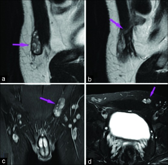 Figure 2: