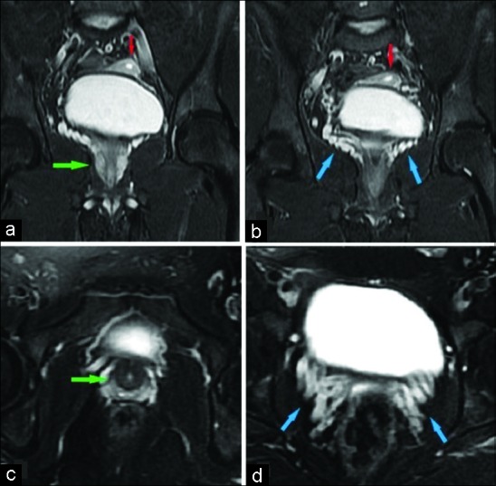 Figure 3: