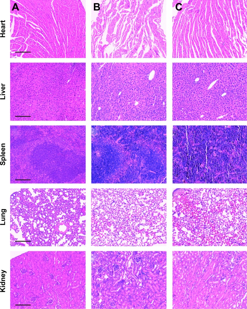 Pirfenidone-loaded liposomes for lung targeting: preparation and in ...