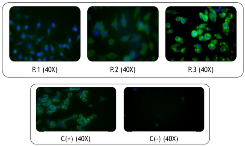 Figure 14