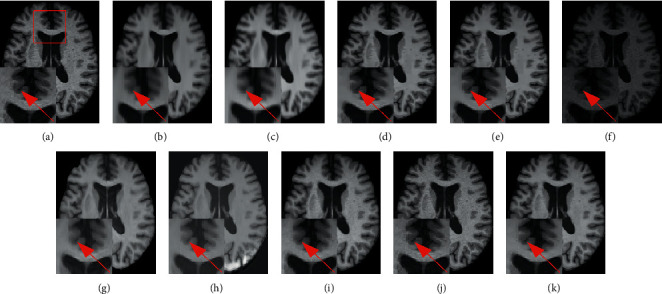 Figure 17