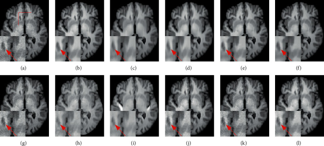 Figure 16