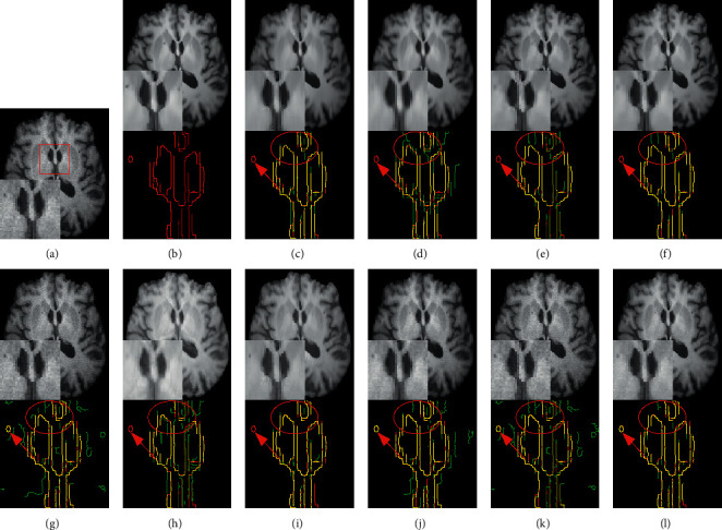 Figure 12