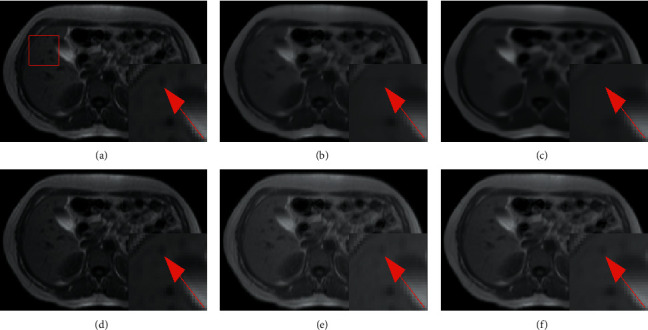 Figure 19