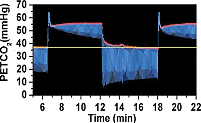 Figure 2d: