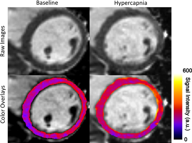 Figure 1a: