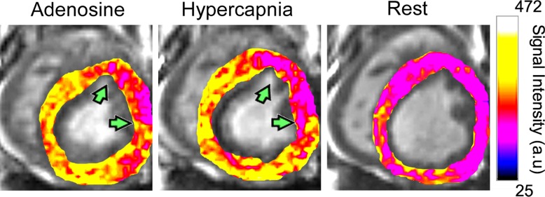 Figure 3a: