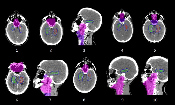 Fig 2