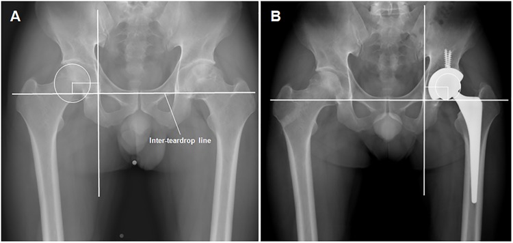 Fig 1