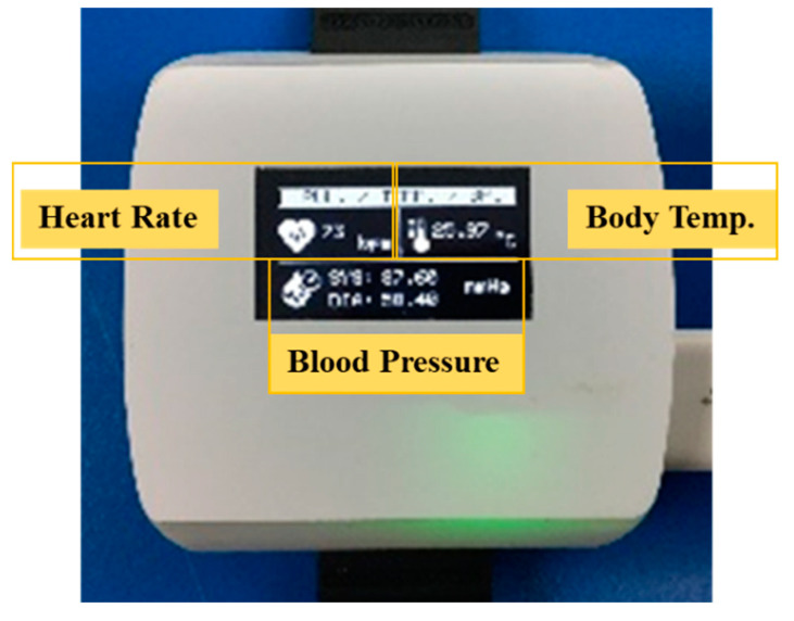 Figure 12