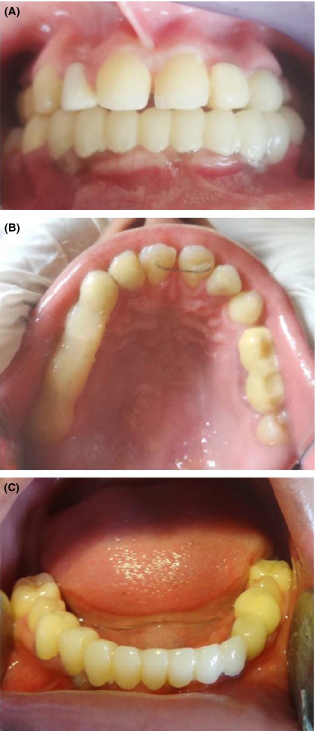 Figure 5