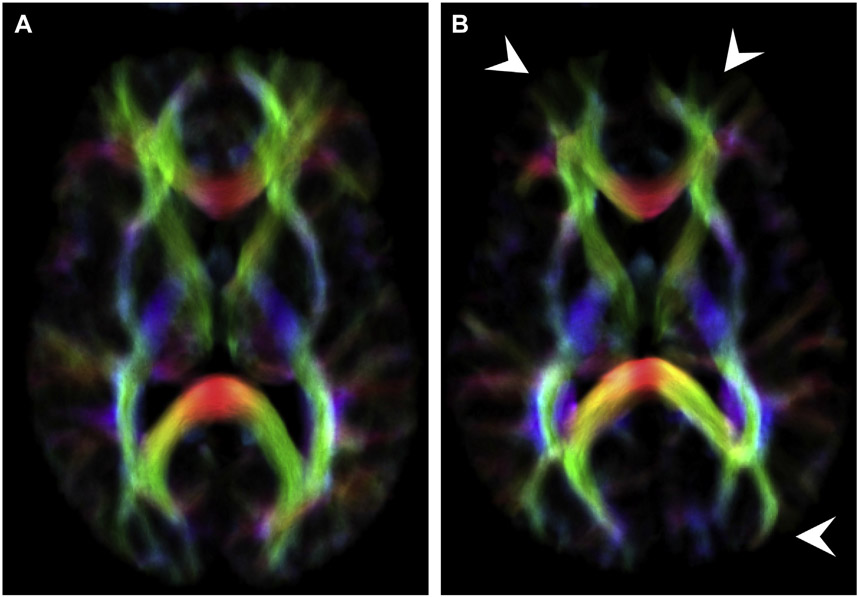 Fig. 6.