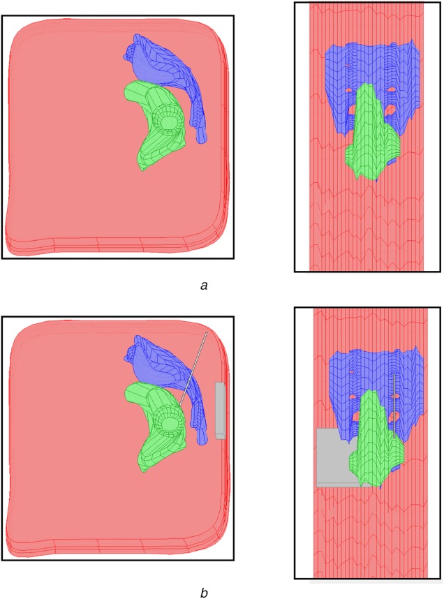 Fig. 2