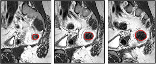 Fig. 1